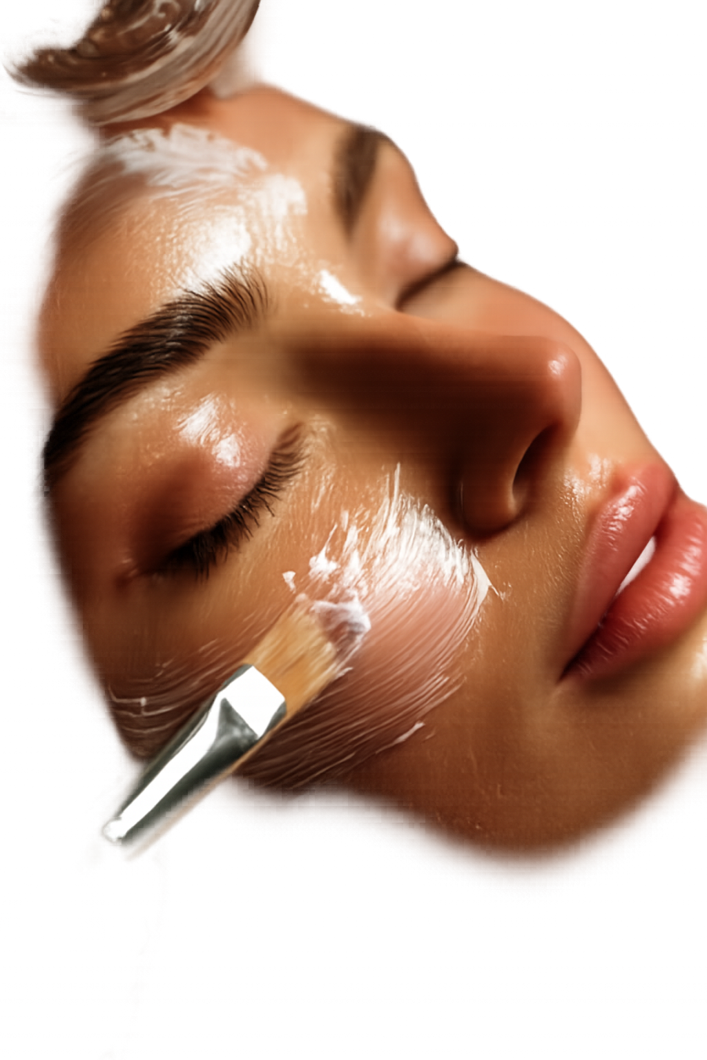 Modelo principal del tratamiento Peeling químico